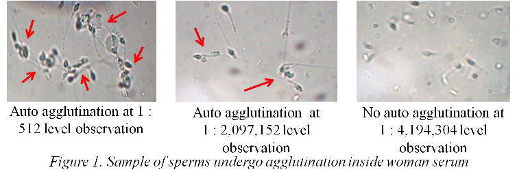 Tator T. reccomend Agglutination of sperm