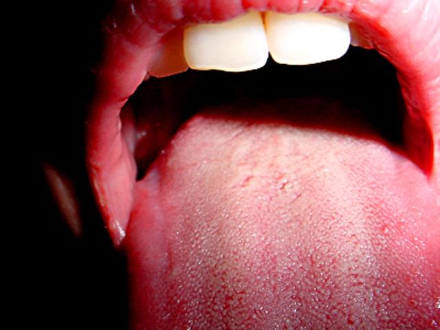 Open throat oral sex