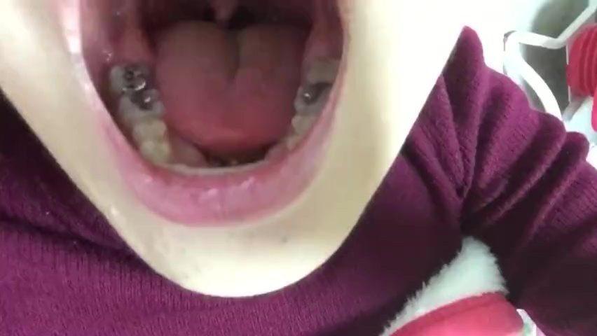 Japanese girl uvula
